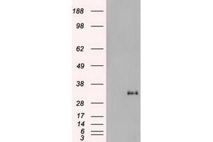 HEK293T cells were transfected with the pCMV6-ENTRY control (Left lane) or pCMV6-ENTRY Noggin (RC205020) (Right lane) cDNA for 48 hrs and lysed. (NOG antibody  (AA 28-232))