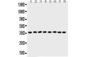 Western Blotting (WB) image for anti-Annexin A5 (ANXA5) (AA 2-320) antibody (ABIN3043502)
