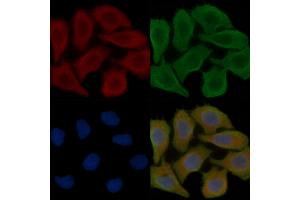 ABIN7096048 and ABIN7100110 staining Hela cells(30 min of UV treatment) by IF/ICC.
