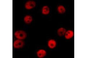 ABIN6269137 staining HT29 by IF/ICC. (Vitamin D Receptor antibody  (Internal Region))