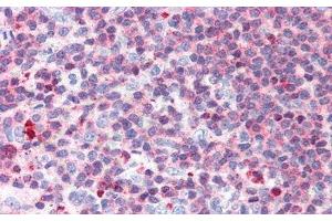 Detection of LTb in Human Spleen Tissue using Polyclonal Antibody to Lymphotoxin Beta (LTb) (LTB antibody  (AA 58-304))