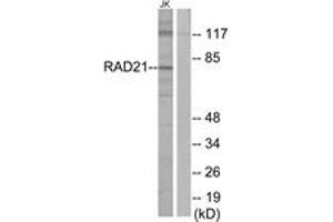 Western blot analysis of extracts from Jurkat cells, using RAD21 Antibody. (RAD21 antibody  (AA 521-570))
