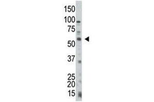 Western Blotting (WB) image for anti-Phosphatase and Tensin Homolog (PTEN) (AA 264-295) antibody (ABIN3032215)