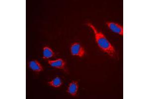 Immunofluorescent analysis of Claudin 5 staining in HeLa cells.