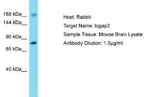 Host: Rabbit Target Name: IQGAP2 Sample Tissue: Mouse Brain Antibody Dilution: 1ug/ml (IQGAP2 antibody  (C-Term))