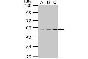 WB Image Sample (30 ug of whole cell lysate) A: A431 , B: H1299 C: Hela 10% SDS PAGE antibody diluted at 1:1000 (CCKBR antibody  (C-Term))