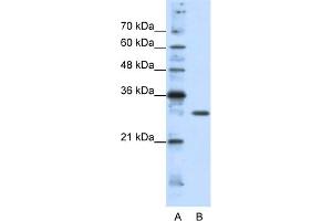 WB Suggested Anti-GSCL Antibody Titration:  1. (GSC2 antibody  (C-Term))