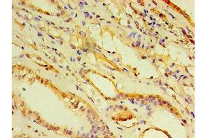 Immunohistochemistry of paraffin-embedded human kidney tissue using ABIN7143455 at dilution of 1:100 (ARF6 antibody  (AA 1-175))