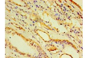 Immunohistochemistry of paraffin-embedded human kidney tissue using ABIN7143455 at dilution of 1:100