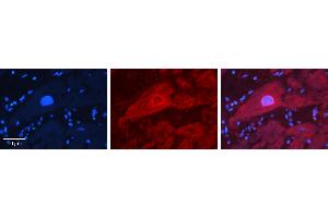 Rabbit Anti-IRF6 Antibody   Formalin Fixed Paraffin Embedded Tissue: Human heart Tissue Observed Staining: Cytoplasmic, nucleus Primary Antibody Concentration: N/A Other Working Concentrations: 1:600 Secondary Antibody: Donkey anti-Rabbit-Cy3 Secondary Antibody Concentration: 1:200 Magnification: 20X Exposure Time: 0. (IRF6 antibody  (Middle Region))