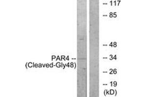 Western blot analysis of extracts from NIH-3T3 cells, treated with etoposide 25uM 1h, using PAR4 (Cleaved-Gly48) Antibody. (F2RL3 antibody  (Cleaved-Gly48))