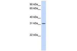 Image no. 1 for anti-Breast Carcinoma Amplified Sequence 2 (BCAS2) (C-Term) antibody (ABIN6740686) (BCAS2 antibody  (C-Term))