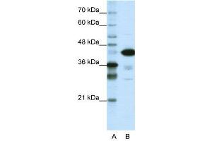 WB Suggested Anti-TARDBP  Antibody Titration: 1. (TARDBP antibody  (N-Term))