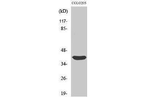 Western Blotting (WB) image for anti-Siah E3 Ubiquitin Protein Ligase 2 (SIAH2) (C-Term) antibody (ABIN3186957) (SIAH2 antibody  (C-Term))