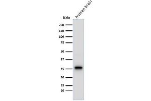 Western Blot Analysis of human brain tissue lysate using PGP9. (UCHL1 antibody)