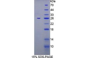 Image no. 1 for FK506 Binding Protein 7 (FKBP7) (AA 24-217) protein (His tag) (ABIN4990280)