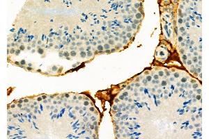 ABIN6265680 and ABIN6278645 at 1/100 staining Mouse testis tissue by IHC-P.