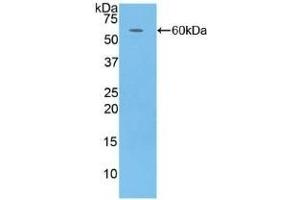 Detection of Recombinant CFD, Human using Polyclonal Antibody to Complement Factor D (CFD) (Adipsin antibody  (AA 1-253))
