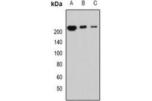 Western blot analysis of Periplakin expression in MCF7 (A), mouse lung (B), mouse heart (C) whole cell lysates. (PPL antibody)