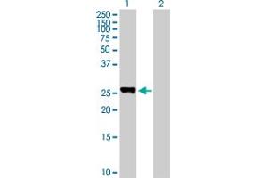Western Blot analysis of PLEKHM1P expression in transfected 293T cell line by PLEKHM1P MaxPab polyclonal antibody. (PLEKHM1P antibody  (AA 1-237))