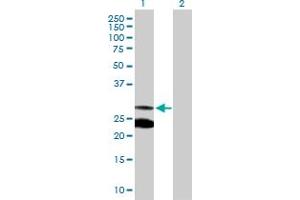 Western Blot analysis of MRRF expression in transfected 293T cell line by MRRF MaxPab polyclonal antibody. (MRRF antibody  (AA 1-262))