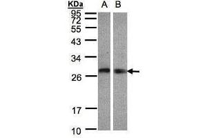 WB Image Sample(30 ug whole cell lysate) A:Hep G2 , B:Raji , 12% SDS PAGE antibody diluted at 1:1000 (LYPLA2 antibody)