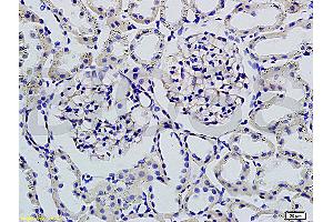 Formalin-fixed and paraffin embedded rat kidney tissue labeled with Rabbit Anti-Podoplanin/gp36 Polyclonal Antibody (ABIN736896), Unconjugated 1:200 followed by conjugation to the secondary antibody and DAB staining