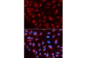 Immunofluorescence analysis of U2OS cell using CTBP1 antibody. (CTBP1 antibody  (AA 20-250))