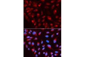 Immunofluorescence analysis of U2OS cell using CTBP1 antibody. (CTBP1 antibody  (AA 20-250))