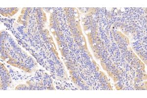 Immunohistochemistry (IHC) image for anti-Tumor Necrosis Factor Receptor Superfamily, Member 11a, NFKB Activator (TNFRSF11A) (AA 330-615) antibody (ABIN7434629)