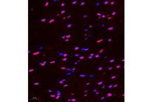 Immunofluorescence of paraffin embedded rat spinal cord using Hes2 (ABIN7074158) at dilution of 1:100 (400x lens) (HES2 antibody)
