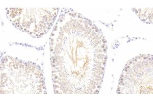 Detection of SNCa in Rat Testis Tissue using Polyclonal Antibody to Synuclein Alpha (SNCa) (SNCA antibody  (AA 23-140))