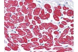 Immunohistochemical analysis of paraffin-embedded human Heart tissues using MYL3 mouse mAb.