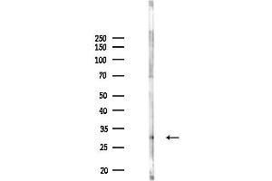 anti-Short Stature Homeobox (SHOX) (N-Term) antibody