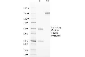 SDS-PAGE Analysis Purified TCL1 Mouse Monoclonal Antibody (TCL1/2078). (TCL1A antibody  (AA 2-109))