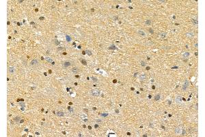 ABIN6257139 and ABIN6275758 at 1/100 staining Rat brain tissue by IHC-P. (DUSP10 antibody  (Internal Region))