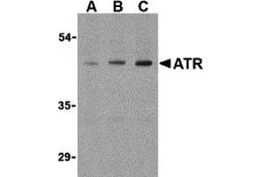 Western Blotting (WB) image for anti-ATR serine/threonine kinase (ATR) (Middle Region) antibody (ABIN1030871) (ATR antibody  (Middle Region))