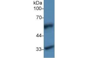 Rabbit Detection antibody from the kit in WB with Positive Control: Sample Human lung lysate.