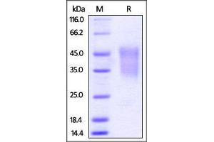 Mouse TIM-3 / HAVCR2, His Tag on SDS-PAGE under reducing (R) condition. (TIM3 Protein (AA 20-191) (His tag))