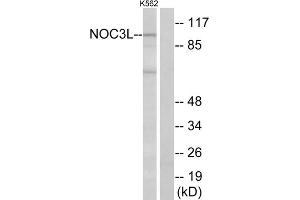 Western blot analysis of extracts from K562 cells, using NOC3L antibody. (NOC3L antibody  (Internal Region))
