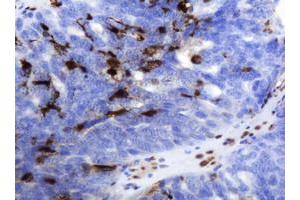Image no. 1 for anti-Thymidine Phosphorylase (TYMP) (AA 311-482) antibody (ABIN1491396) (Thymidine Phosphorylase antibody  (AA 311-482))