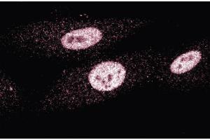 Immunofluorescence staining of human fibroblasts. (MSH3 antibody  (AA 136-349))
