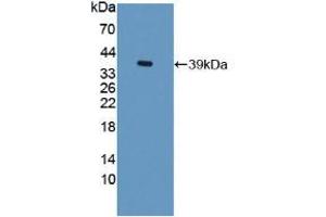 Western blot analysis of recombinant Rat TFF3. (TFF3 antibody  (AA 23-81))