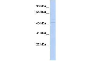 WB Suggested Anti-PAX1 Antibody Titration:  0. (PAX1 antibody  (Middle Region))