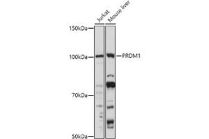 Western blot analysis of extracts of various cell lines, using (ABIN6128500, ABIN6146126, ABIN6146127 and ABIN6219111) at 1:1000 dilution. (PRDM1 antibody  (AA 1-240))
