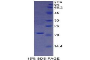 SDS-PAGE (SDS) image for Cathepsin L1 (CTSL1) (AA 114-288) protein (His tag) (ABIN1170047) (Cathepsin L Protein (AA 114-288) (His tag))