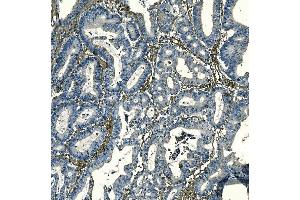 IHC analysis of F2R using anti-F2R antibody (ABIN7599952).