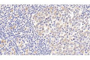 Detection of HSPA8 in Human Tonsil Tissue using Polyclonal Antibody to Heat Shock 70 kDa Protein 8 (HSPA8) (Hsc70 antibody  (AA 534-615))