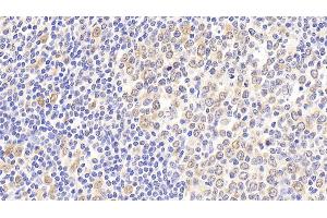 Detection of HSPA8 in Human Tonsil Tissue using Polyclonal Antibody to Heat Shock 70 kDa Protein 8 (HSPA8) (Hsc70 antibody  (AA 534-615))