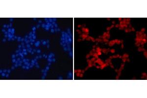 Immunofluorescence analysis of 293T cells using Asymmetric DiMethyl-Histone H4-R3 Polyclonal Antibody (Histone H4 antibody  (H4R3me2a))